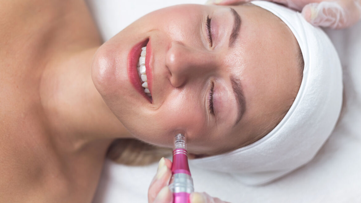 Professional Microneedling in London