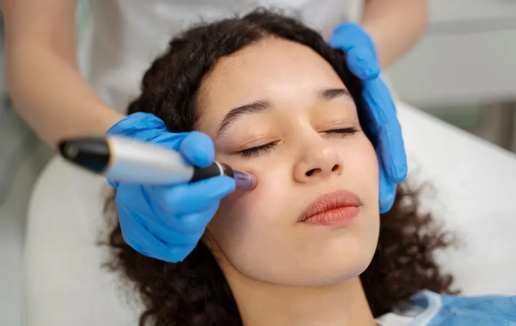 How many sessions of microneedling do you need