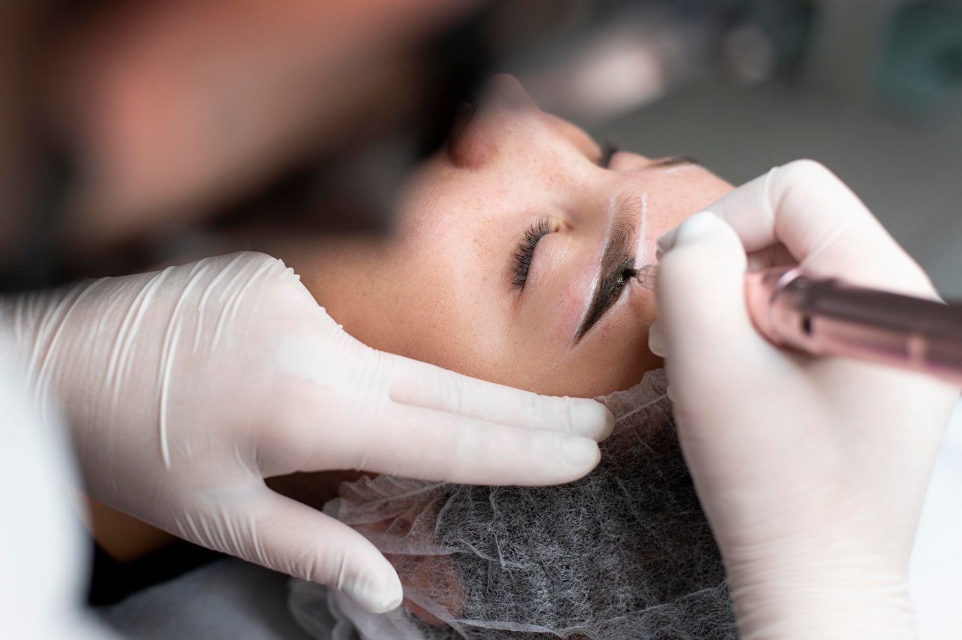 Can Permanent Makeup Be Removed or Corrected